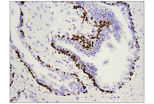 Immunohistochemistry Image 3: p63 (D9L7L) XP<sup>®</sup> Rabbit mAb