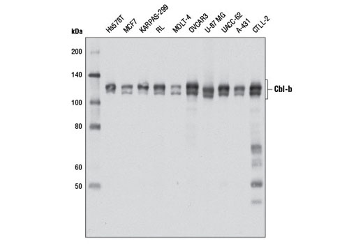 Western Blotting Image 2: Cbl-b (D3C12) Rabbit mAb
