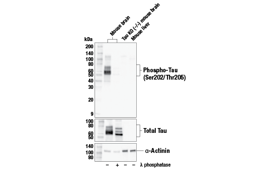 Western Blotting Image 1: Phospho-Tau (Ser202/Thr205) (E6S2W) Rabbit mAb