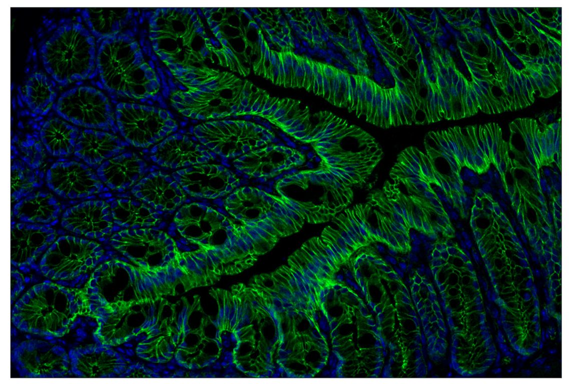 Immunohistochemistry Image 2: β-Catenin (D10A8) XP<sup>®</sup> Rabbit mAb (Alexa Fluor<sup>®</sup> 488 Conjugate)