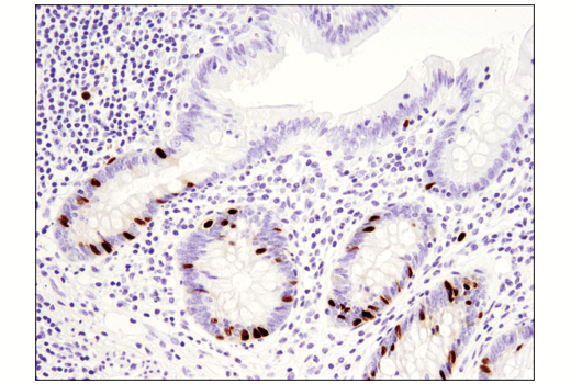 Immunohistochemistry Image 1: PAF15 (D8E2Y) XP<sup>®</sup> Rabbit mAb