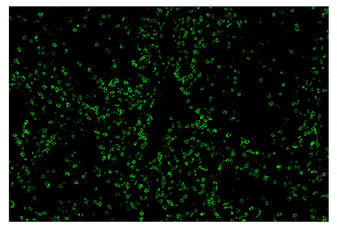 Immunohistochemistry Image 2: CD8α (D8A8Y) & CO-0004-647 SignalStar<sup>™</sup> Oligo-Antibody Pair