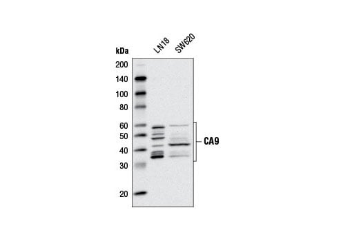 Western Blotting Image 1: CA9 (D47G3) Rabbit mAb