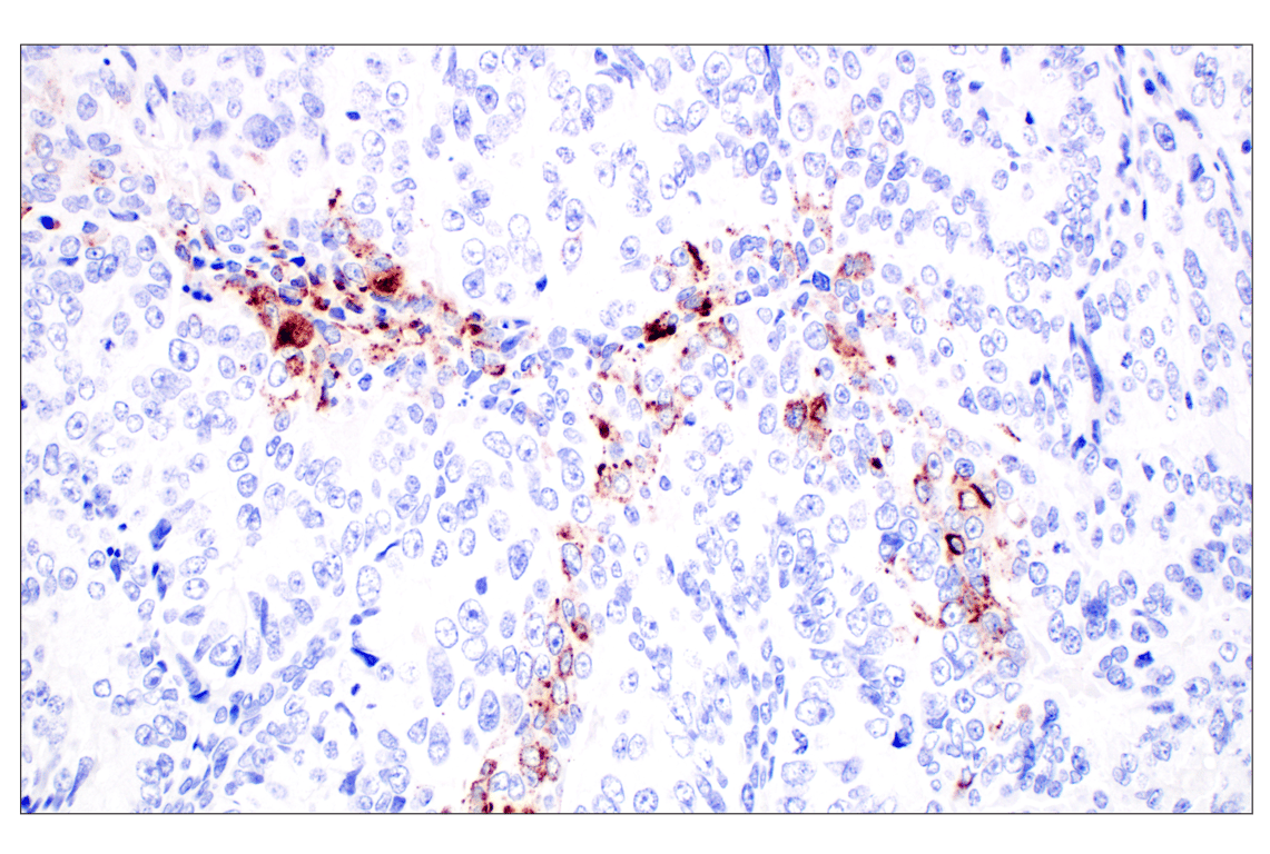 Immunohistochemistry Image 2: CHGA (F7D6H) Rabbit mAb