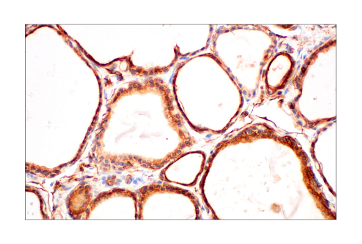 Immunohistochemistry Image 8: Phospho-Tyrosine (4G10) Mouse mAb