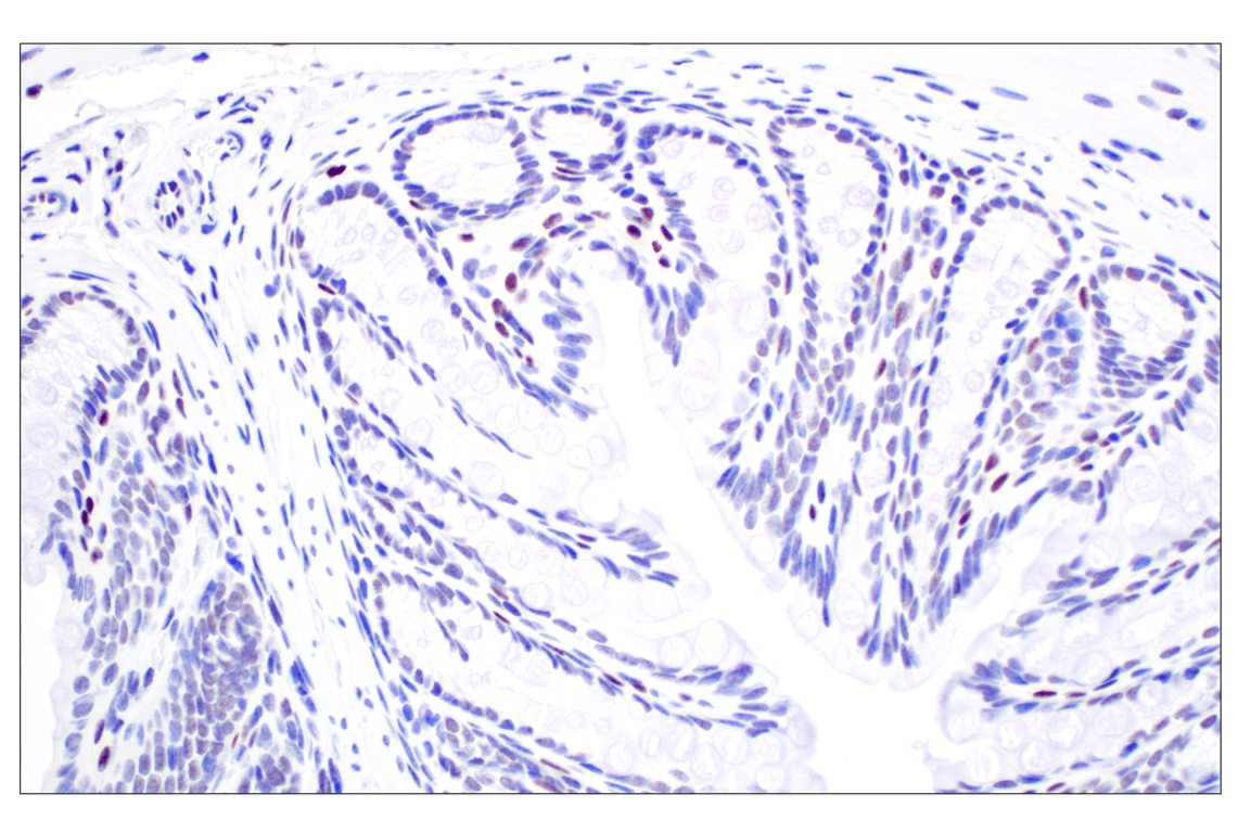 Immunohistochemistry Image 4: TCF4/ITF2 (E3X2Y) Rabbit mAb