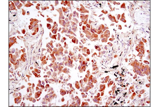 Immunohistochemistry Image 2: FGF Receptor 1 (D8E4) XP<sup>®</sup> Rabbit mAb (BSA and Azide Free)