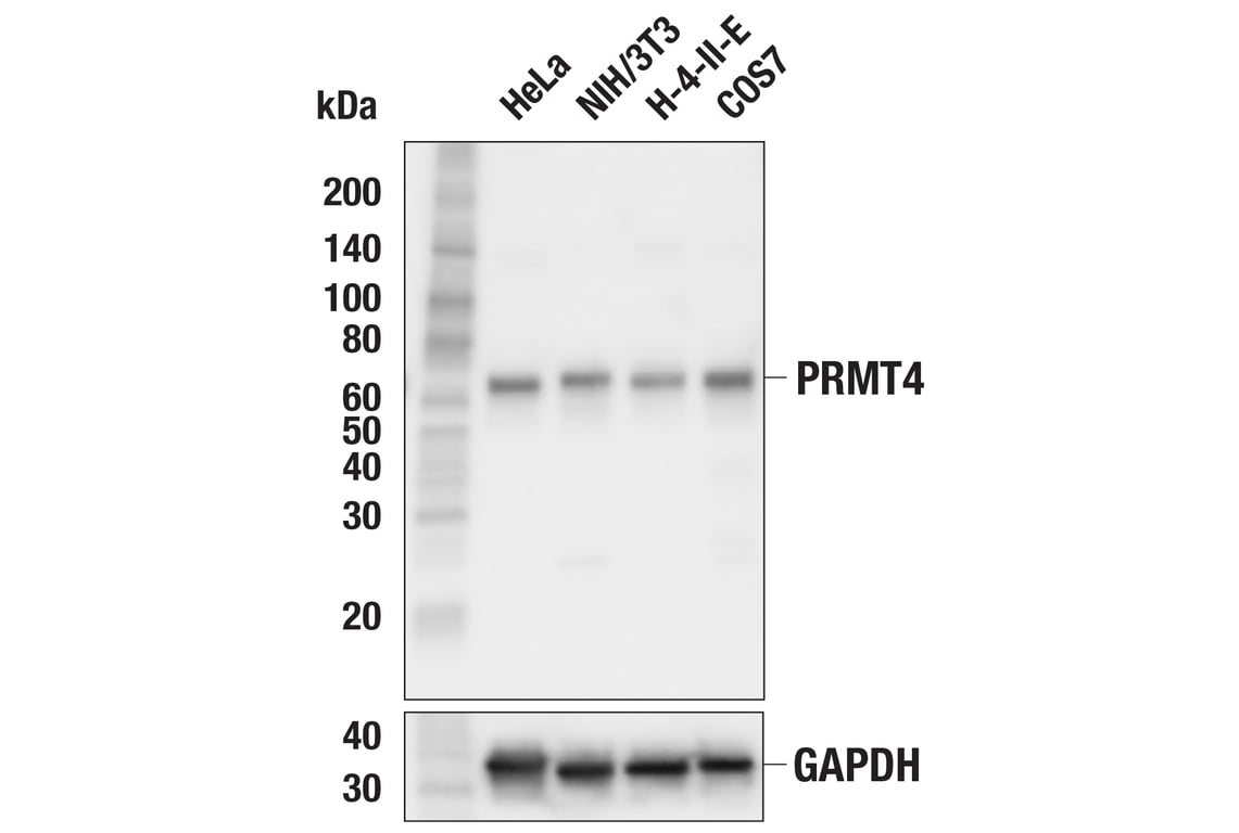 Western Blotting Image 1: PRMT4/CARM1 (C31G9) Rabbit mAb