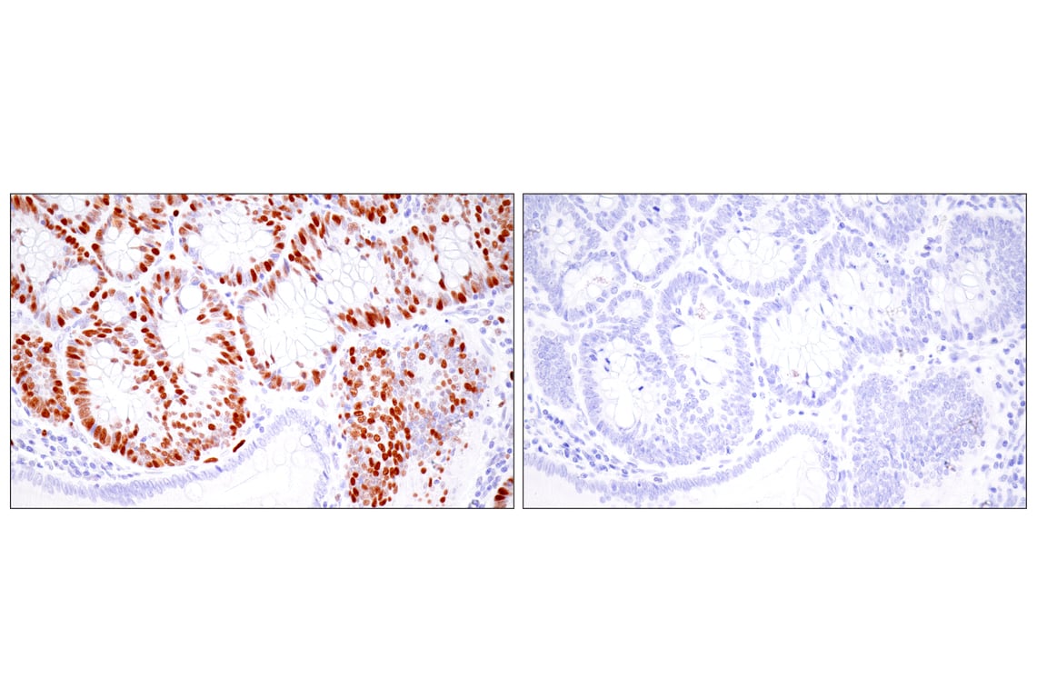 Immunohistochemistry Image 14: UHRF1 (E5W8W) Rabbit mAb