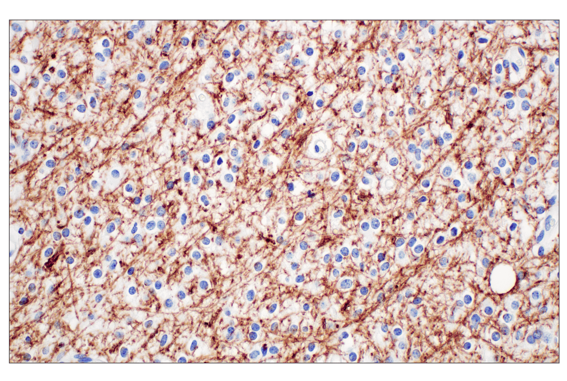 undefined Image 15: Demyelinating Disease Targets Antibody Sampler Kit