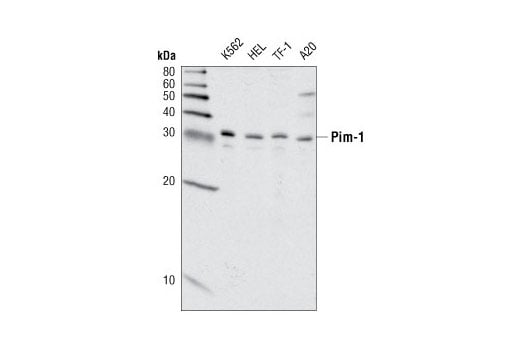 undefined Image 1: Pim Kinase Antibody Sampler Kit
