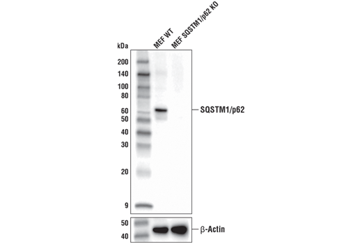 Western Blotting Image 3: SQSTM1/p62 (D1Q5S) Rabbit mAb