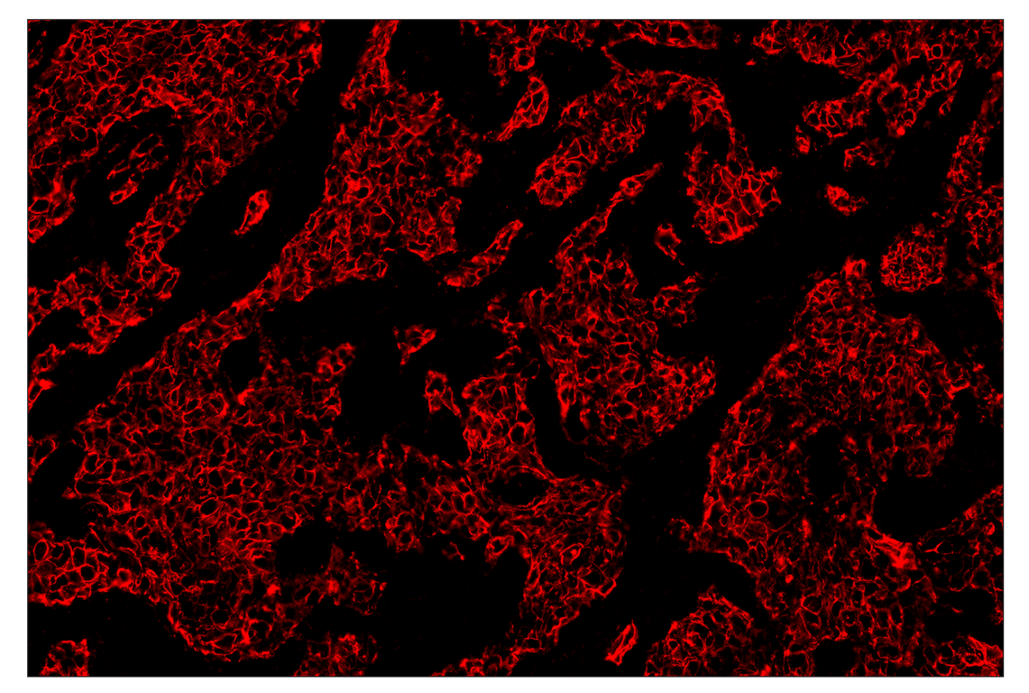 Immunohistochemistry Image 4: HER2/ErbB2 (D8F12) & CO-0059-488 SignalStar<sup>™</sup> Oligo-Antibody Pair