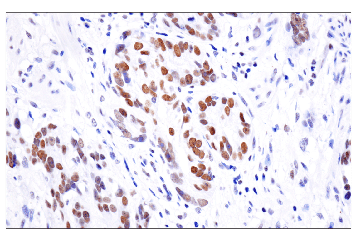 Immunohistochemistry Image 1: Acetyl-Histone H4 (Lys16) (E2B8W) Rabbit mAb