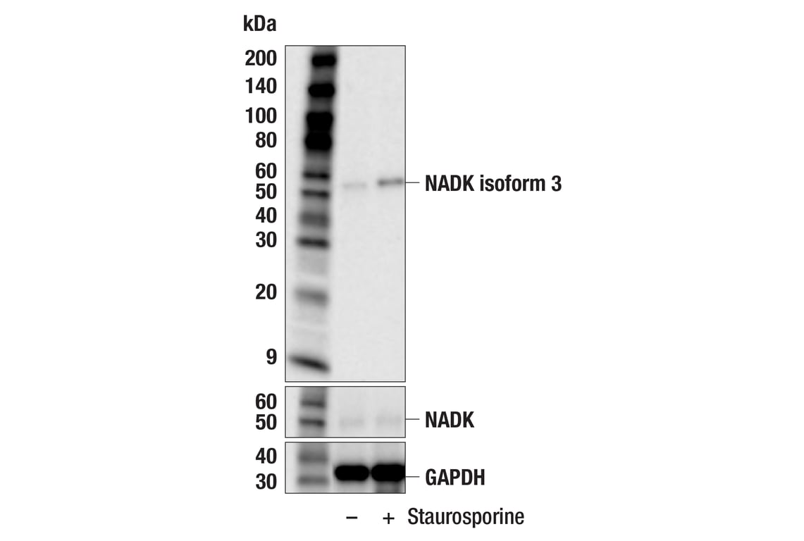 Western Blotting Image 3: NADK Isoform 3 (F5E2T) Rabbit mAb