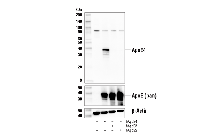 undefined Image 19: Late-Onset Alzheimer's Disease Risk Gene Antibody Sampler Kit