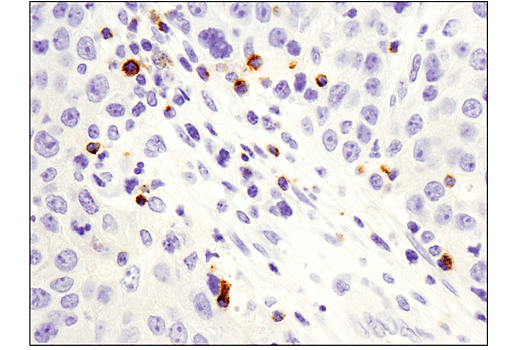 undefined Image 16: Human Exhausted CD8<sup>+</sup> T Cell IHC Antibody Sampler Kit