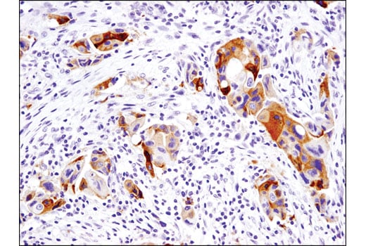 Immunohistochemistry Image 2: Ret (E1N8X) XP<sup>®</sup> Rabbit mAb