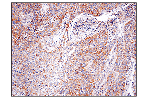 undefined Image 11: Branched-Chain Amino Acid Metabolism Antibody Sampler Kit