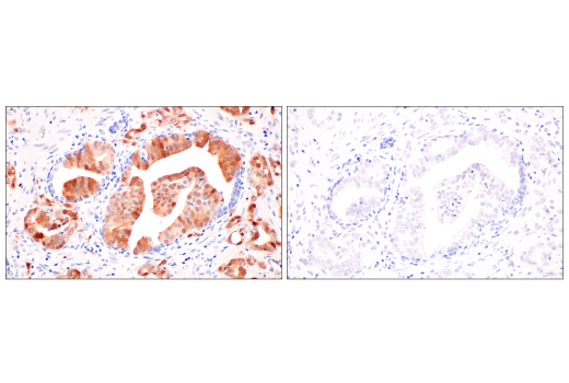 Immunohistochemistry Image 10: p16 INK4A (BC42) Mouse mAb