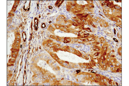 Immunohistochemistry Image 3: ASS1 (D4O4B) XP<sup>®</sup> Rabbit mAb