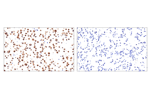 Immunohistochemistry Image 5: Iba1/AIF-1 (E4O4W) XP<sup>®</sup> Rabbit mAb (BSA and Azide Free)