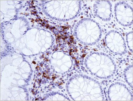 使用 CD19 (Intracellular Domain) (D4V4B) XP<sup>®</sup> Rabbit mAb 对石蜡包埋的人扁桃体细胞进行免疫组织化学分析。