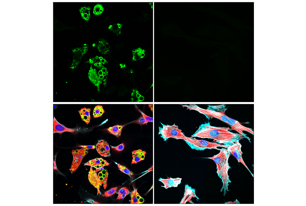 Immunofluorescence Image 1: Perilipin-1 (D1D8) XP<sup>®</sup> Rabbit mAb (Alexa Fluor<sup>®</sup> 488 Conjugate)