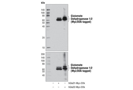 undefined Image 1: Glutamine Metabolism Antibody Sampler Kit