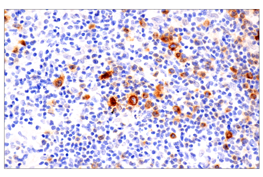 Immunohistochemistry Image 1: TNFRSF8/CD30 (E4L4I) XP<sup>®</sup> Rabbit mAb