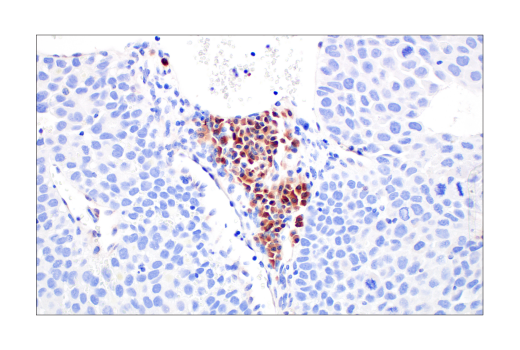 Immunohistochemistry Image 4: Asparagine Synthetase (E6C2C) XP<sup>®</sup> Rabbit mAb (BSA and Azide Free)