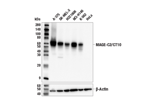 Western Blotting Image 1: MAGE-C2/CT10 (E7B8D) XP<sup>®</sup> Rabbit mAb