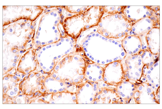 Immunohistochemistry Image 2: Integrin α1/CD49a (E9K2J) XP<sup>®</sup> Rabbit mAb (BSA and Azide Free)