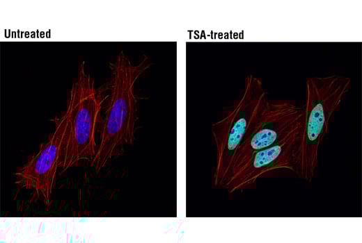 Immunofluorescence Image 1: Acetyl-Histone H2B (Lys5) (D5H1S) XP<sup>®</sup> Rabbit mAb