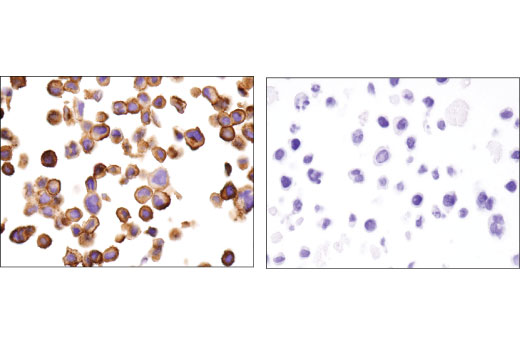 Immunohistochemistry Image 3: IFITM3 (D8E8G) XP<sup>®</sup> Rabbit mAb (BSA and Azide Free)