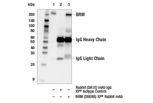 undefined Image 74: BAF Complex IHC Antibody Sampler Kit