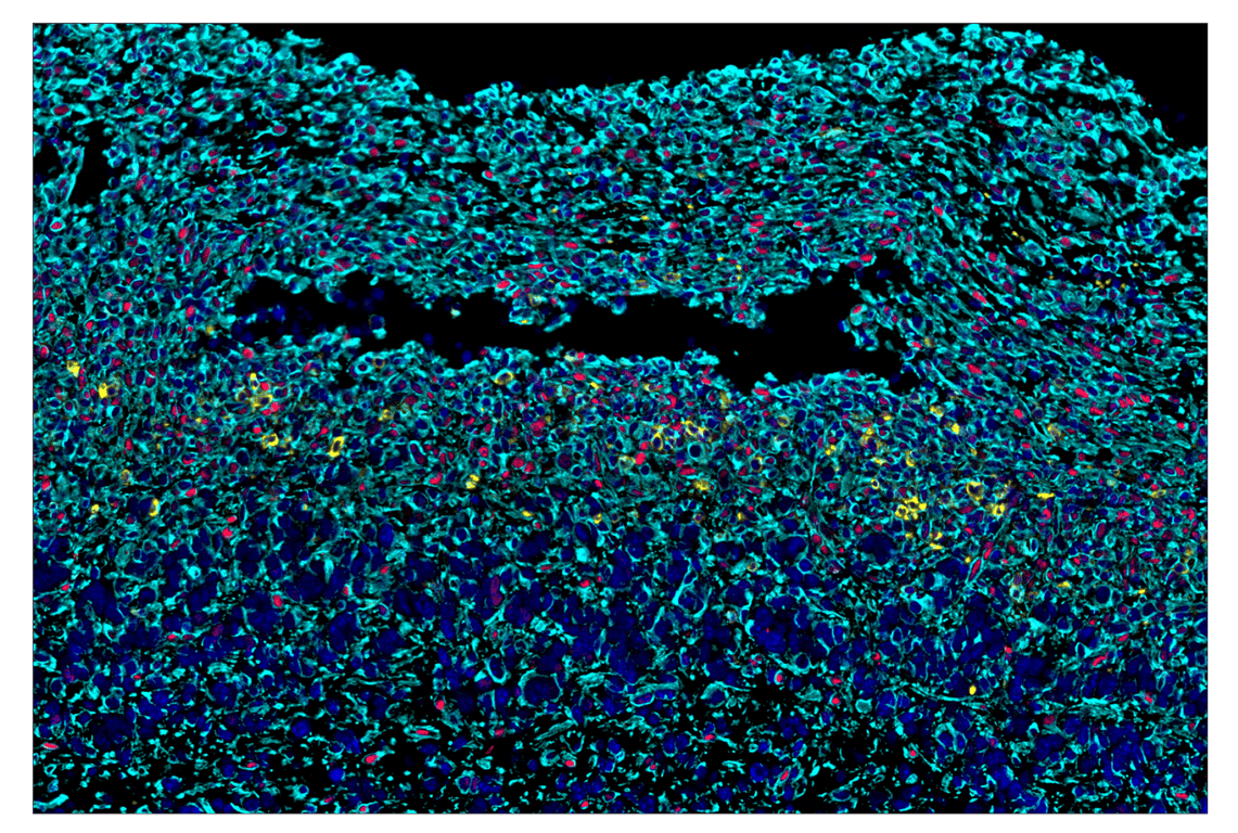 Immunohistochemistry Image 8: Phospho-SLP-76 (Ser376) (E3G9U) & CO-0018-750 SignalStar<sup>™</sup> Oligo-Antibody Pair