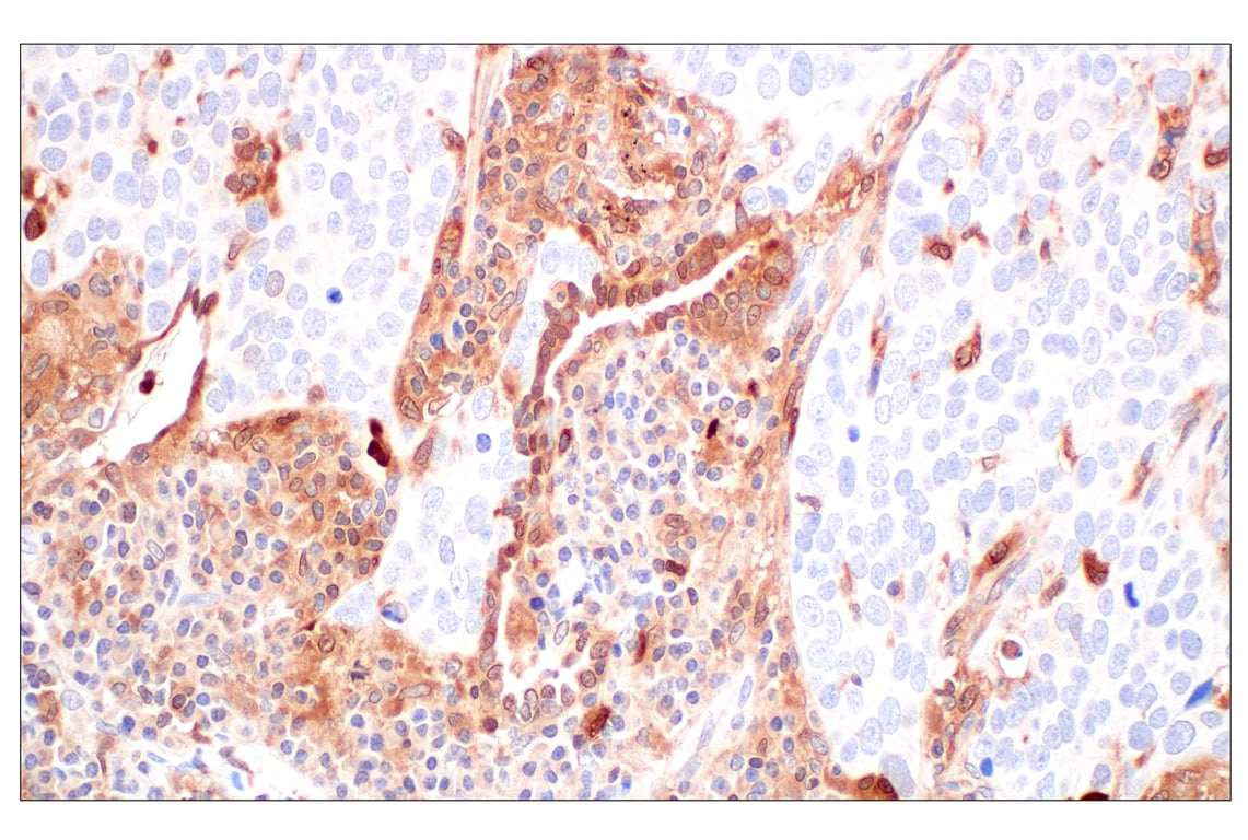 Immunohistochemistry Image 2: SerpinB1 (E4W7B) Rabbit mAb