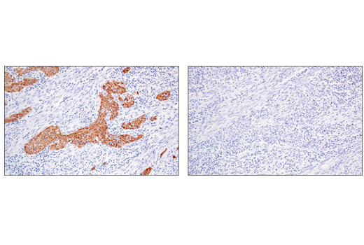 Immunohistochemistry Image 3: MAGE-A4 (E7O1U) XP<sup>®</sup> Rabbit mAb