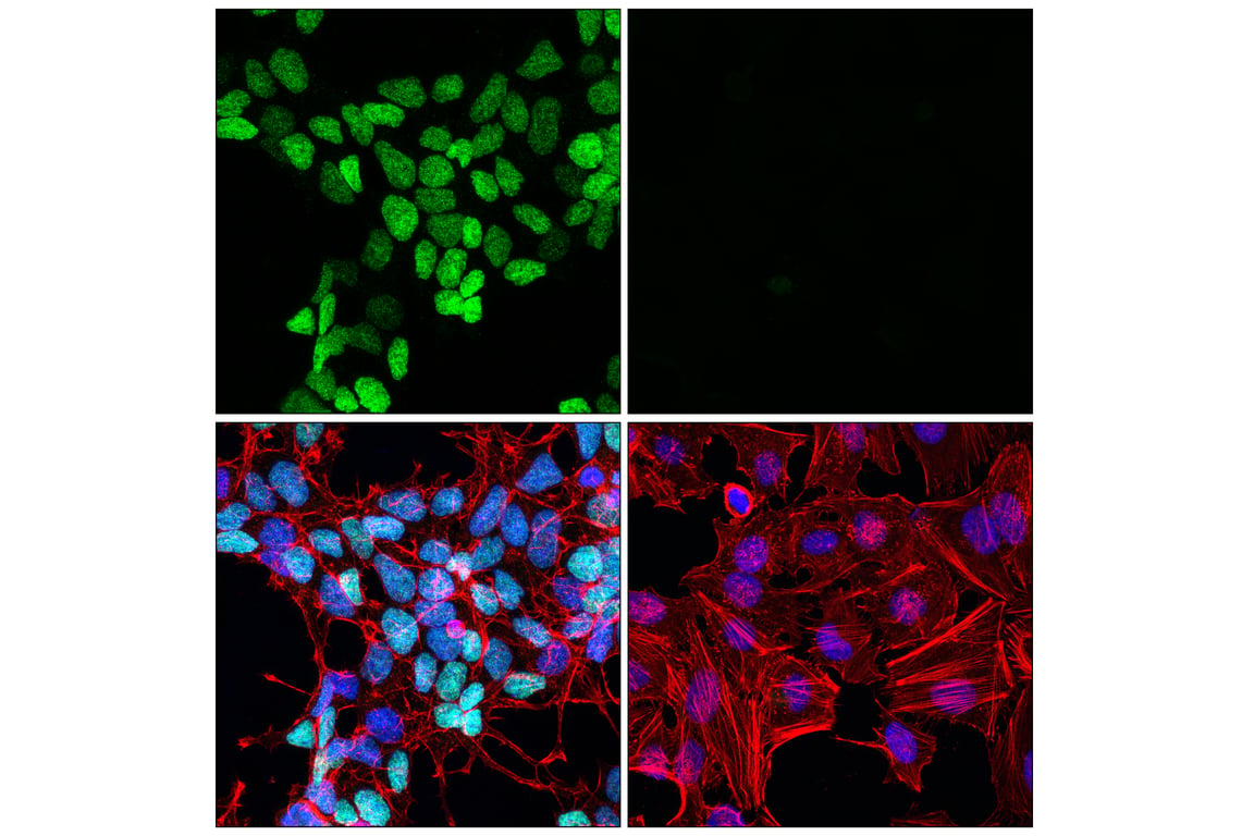 Immunofluorescence Image 1: PHOX2B (E4Q9R) Rabbit mAb