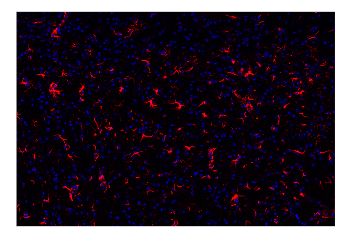 Immunohistochemistry Image 1: GFAP (E4L7M) XP<sup>®</sup> Rabbit mAb (Alexa Fluor<sup>®</sup> 647 Conjugate)