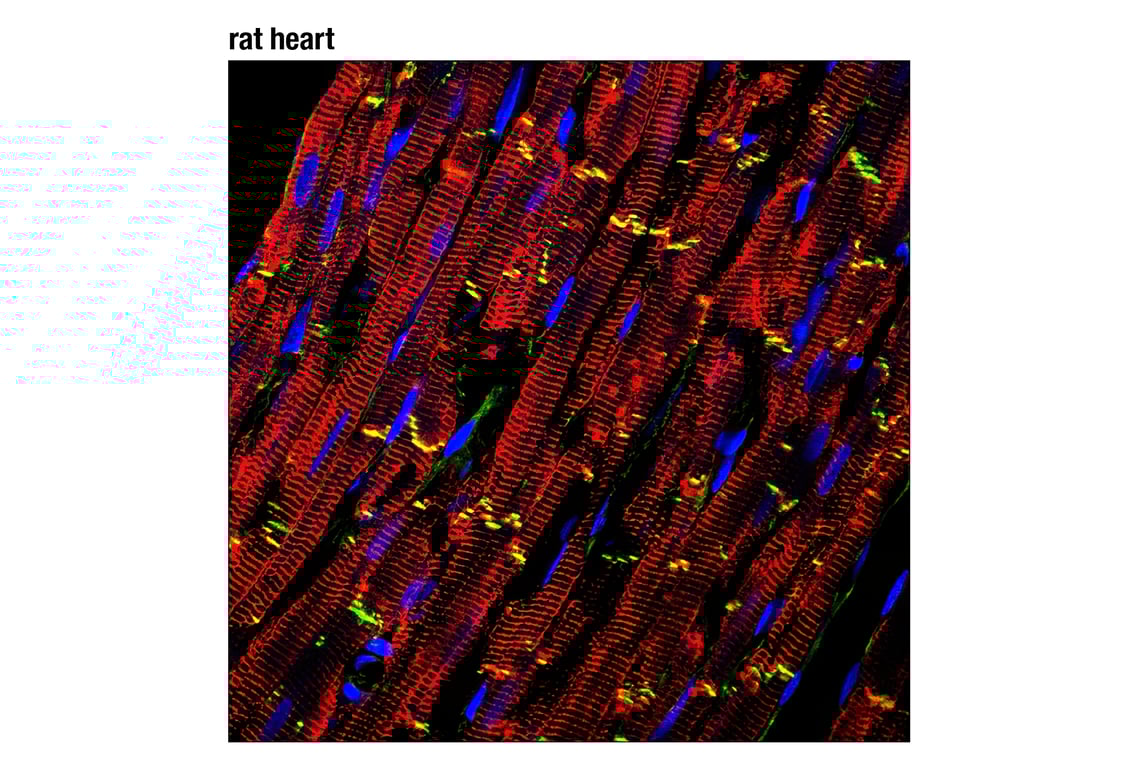 Immunofluorescence Image 1: β-Catenin (L54E2) Mouse mAb (Alexa Fluor<sup>®</sup> 488 Conjugate)