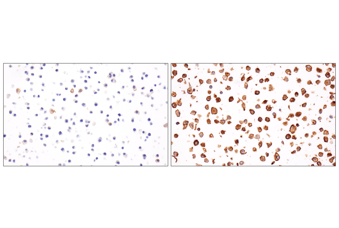 Immunohistochemistry Image 6: PD-L1 (F3Z1T) Rabbit mAb (IHC Formulated)