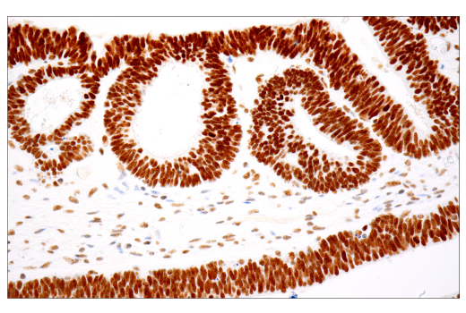 undefined Image 19: BAF Complex IHC Antibody Sampler Kit