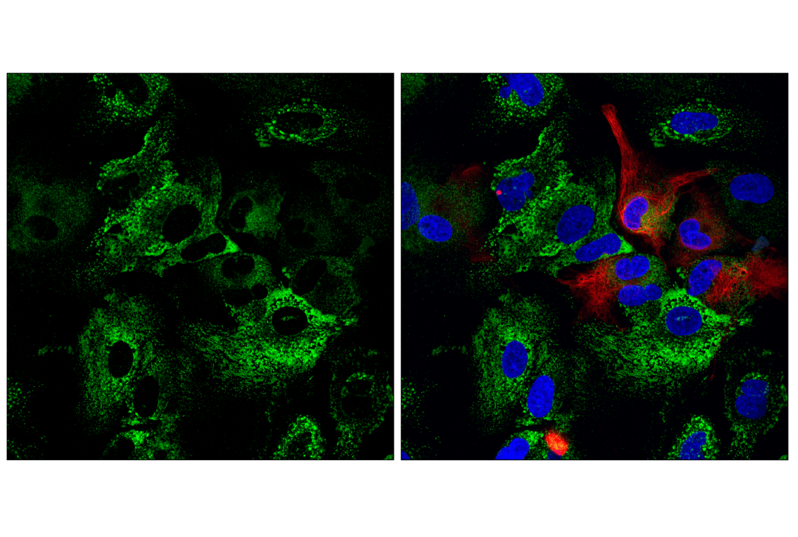 undefined Image 20: Organelle Localization IF Antibody Sampler Kit