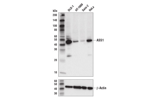 Western Blotting Image 1: ASS1 (D4O4B) XP<sup>®</sup> Rabbit mAb