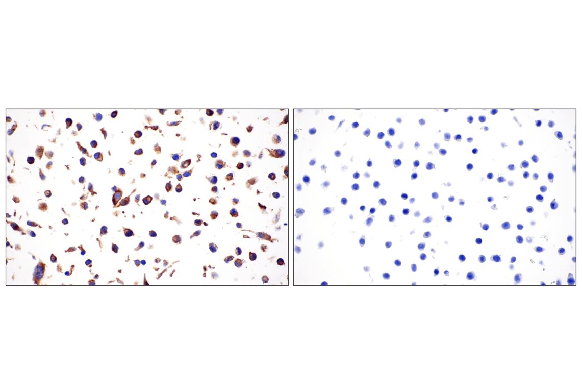 Immunohistochemistry Image 4: FGF Receptor 1 (D8E4) XP<sup>®</sup> Rabbit mAb