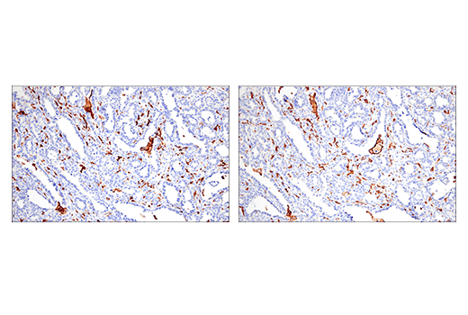 Immunohistochemistry Image 3: Iba1/AIF-1 (E4O4W) XP<sup>®</sup> Rabbit mAb (BSA and Azide Free)