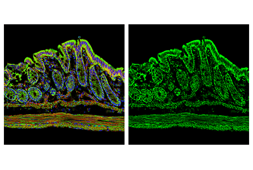 Immunofluorescence Image 1: MAVS (E8Z7M) Rabbit mAb