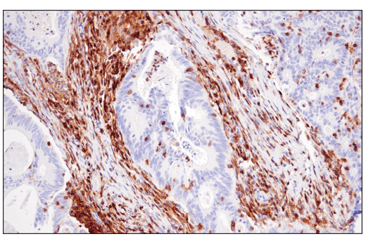 Immunohistochemistry Image 1: CD48 (D7L8I) XP<sup>®</sup> Rabbit mAb (BSA and Azide Free)